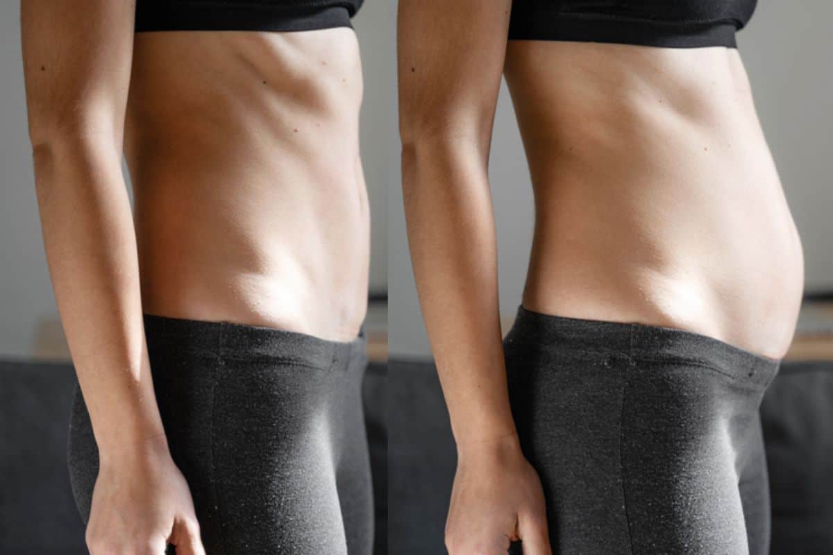 How long does diastasis recti take to improve Daventry?