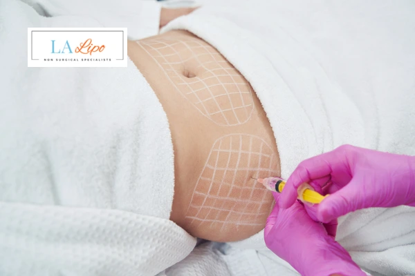 aqualyx fat dissolving injections Daventry