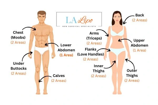 LA LIPO Cryolipolysis Areas Daventry