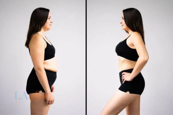 link between body image and mental health Daventry