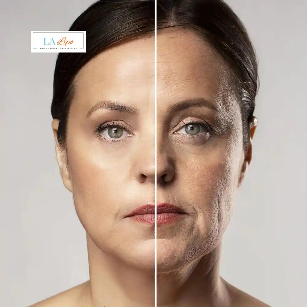 How Can You Tell If Non-Surgical Skin Tightening Is Right for You Daventry?