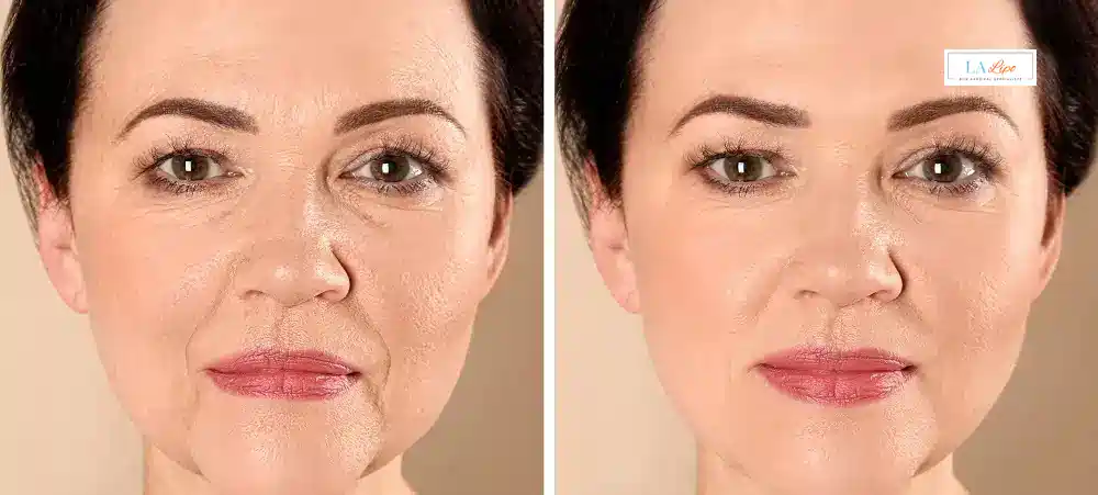 How Long Does It Take to See Results and How Long Do They Last Daventry?